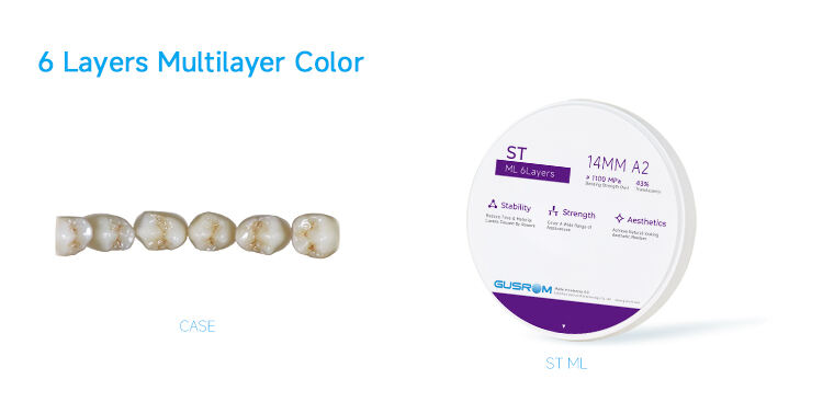 3-Muti Layer Zirconia in Dentistry.jpg