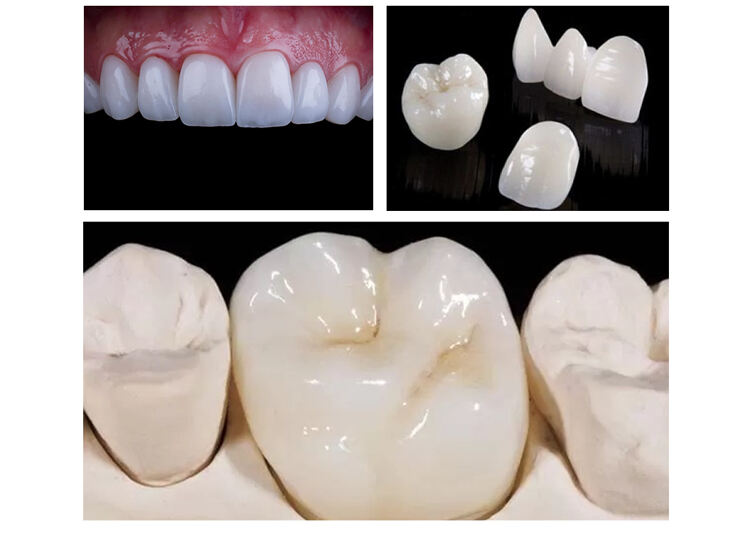 09-Gusrom Dental Zirconia Porcelain Tooth.jpg