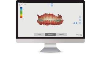 4d x ml  the ideal restoration choice in the digital dentistry era-1