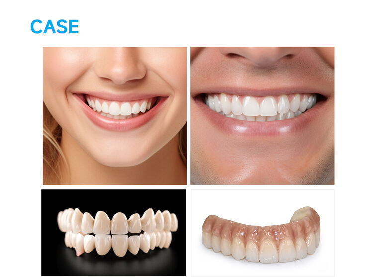 08-Case of Dental Zirconia Tooth.jpg