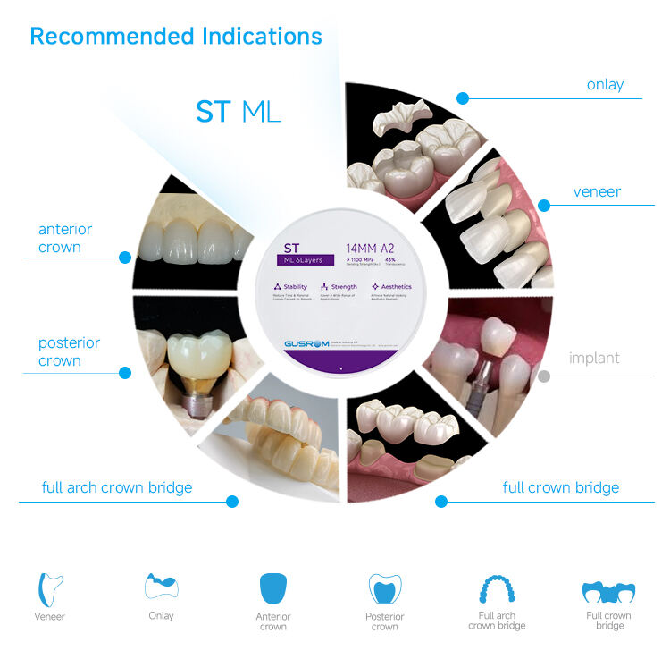 4-High Translucency Zirconia Ceramica.jpg