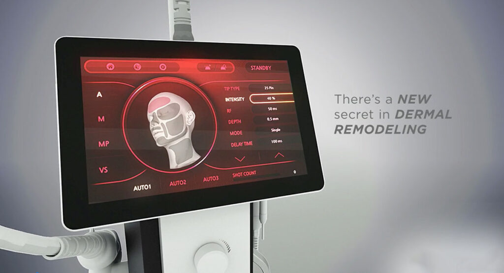 About RF Microneedling Harness the Benefits of Collagen Production