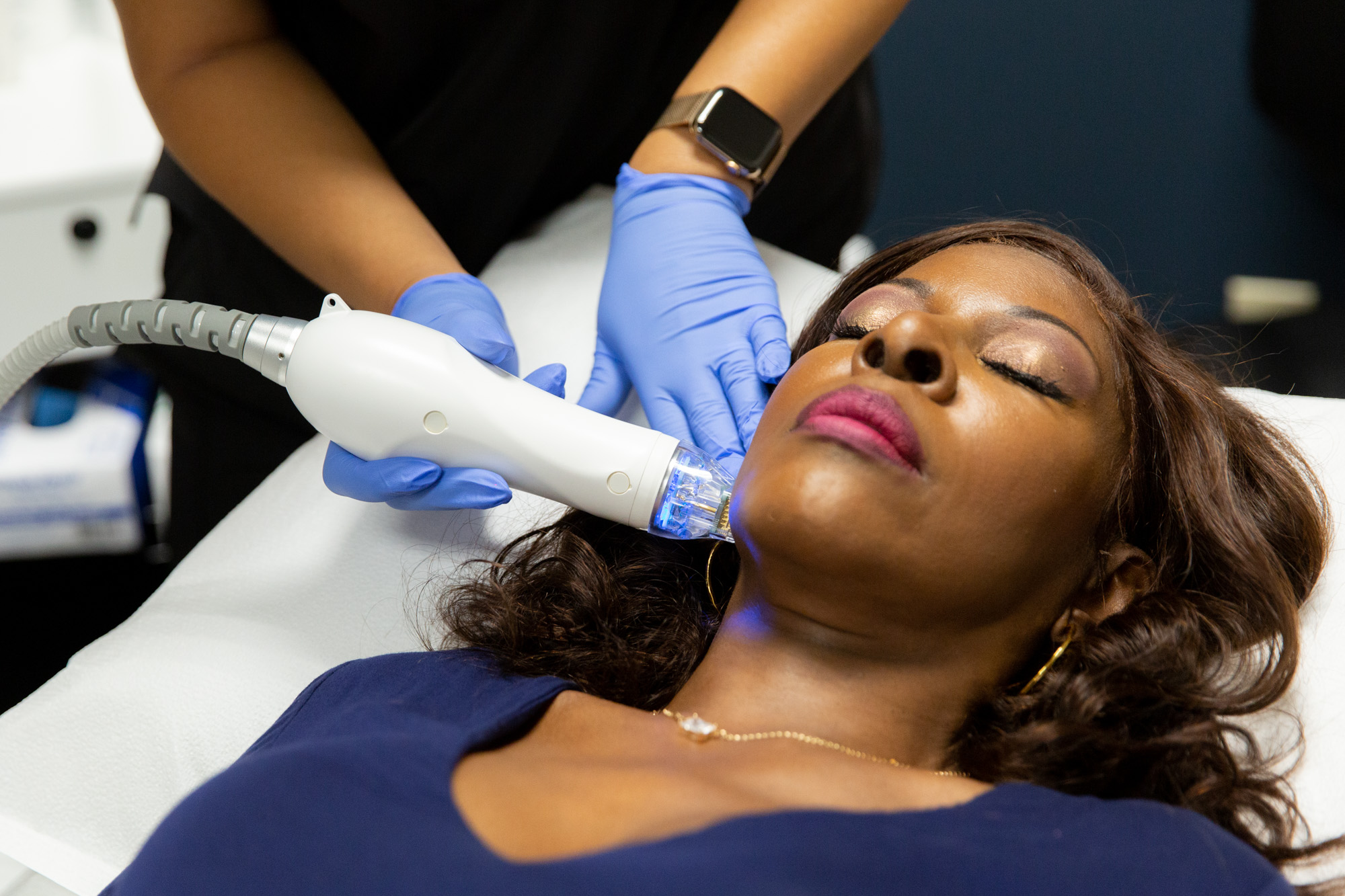 Experience the Difference with Secret RF Microneedling Machine in Your Spa