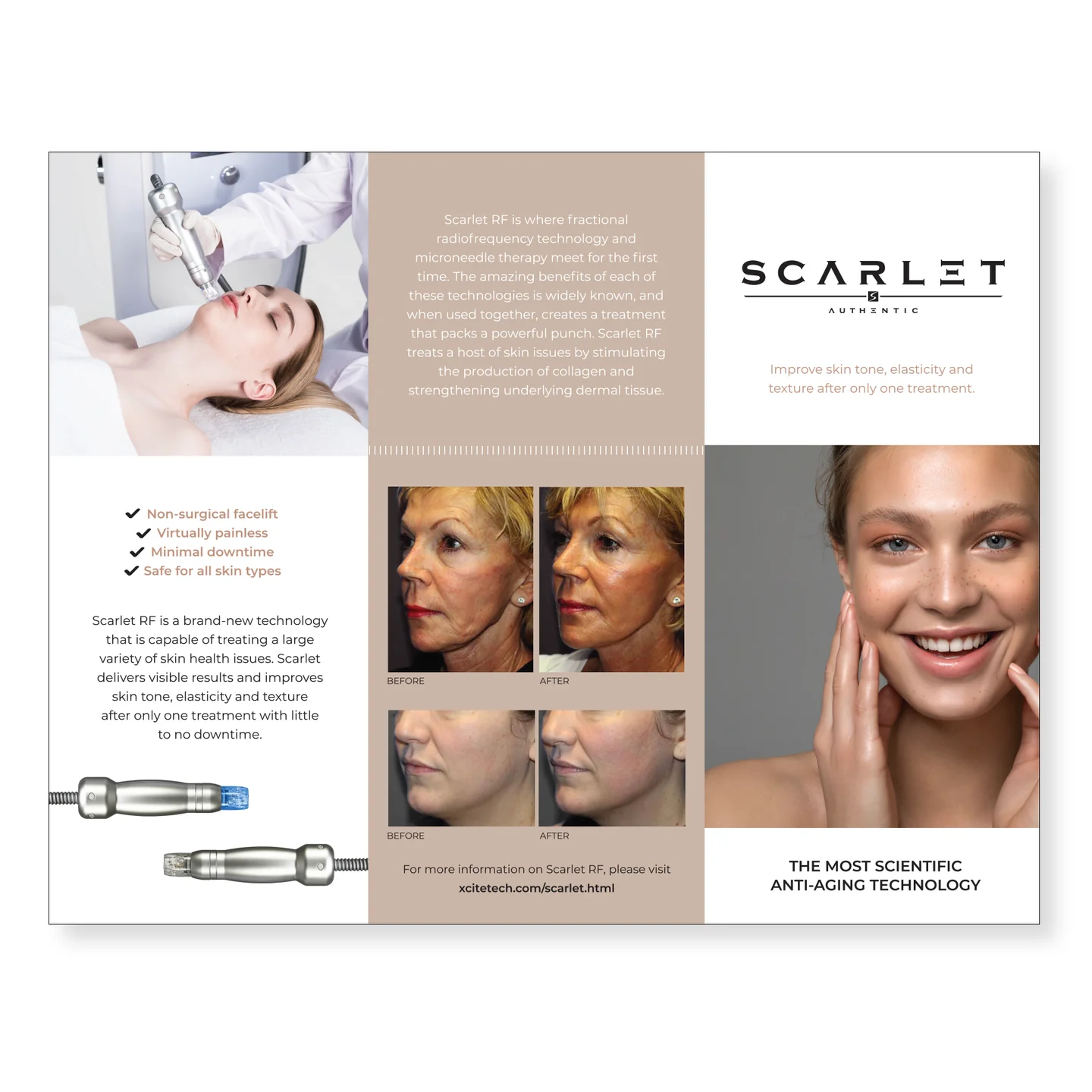 Experience Youthful Glow with Top-Notch Scarlet RF Treatmen