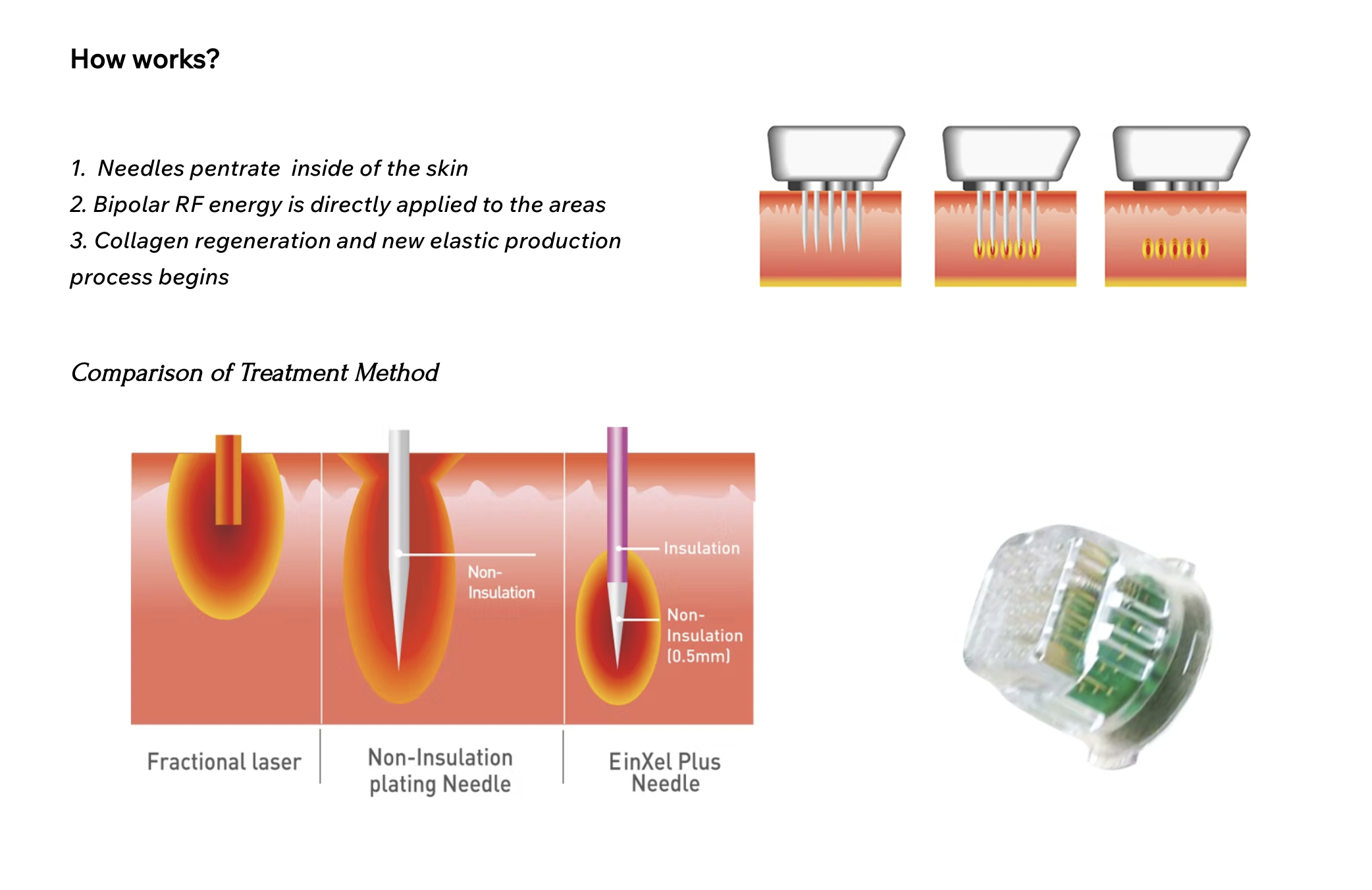 Now You Can Enjoy The Advantages Of Non-Surgical Fractional RF For Your Skin