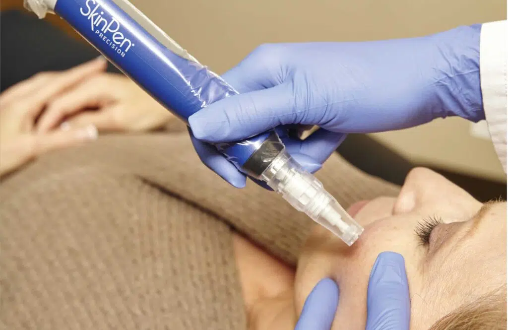 Firm and smooth your neck area with our premium microneedling treatmen