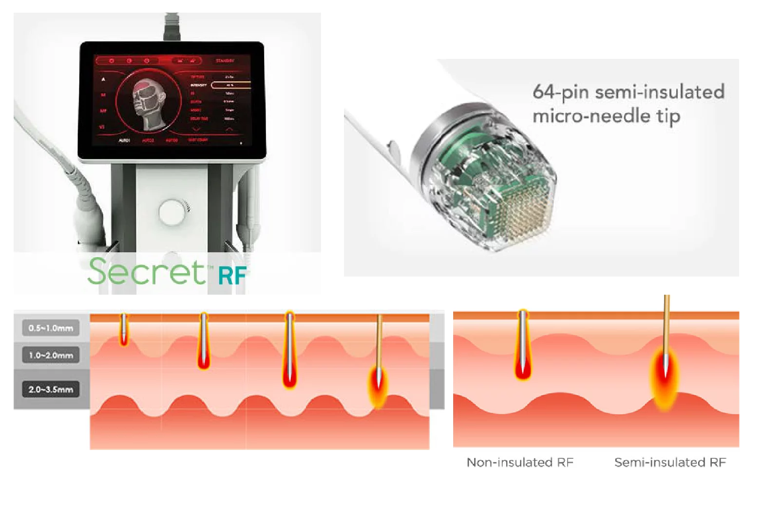 Where to find the best secret rf treatment products