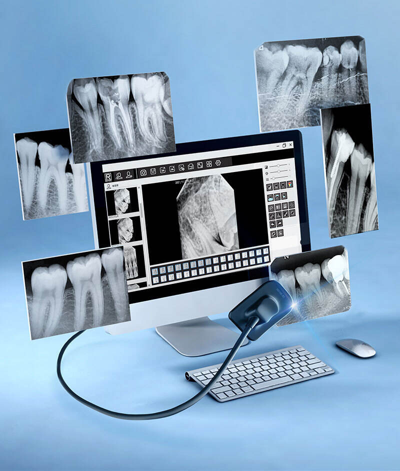Hochpräzise Hybridkabel im Vergleich zu feinen Koaxialkabeln: Die Entschlüsselung der Grundlage moderner zahnärztlicher Endoskope