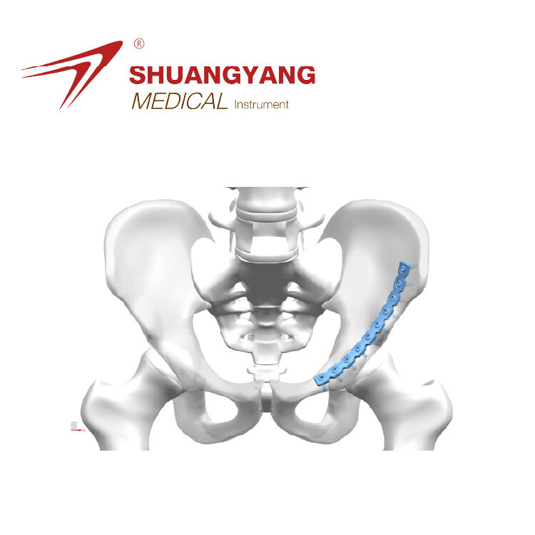 Pelvic Arc reconstruction locking plate II