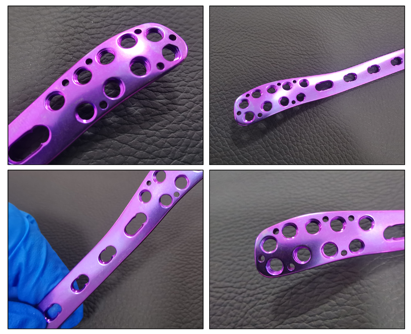 distal fibular locking plate630-3