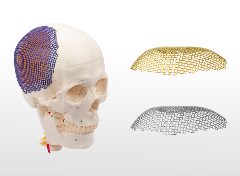 anatomical 2d round hole titanium mesh used for skull restoration system-1