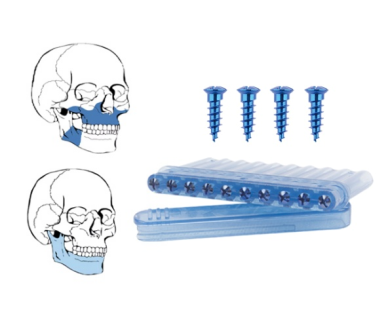 10mm thickness orthognathic series l plate titanium maxillofacial plate6 holes-5