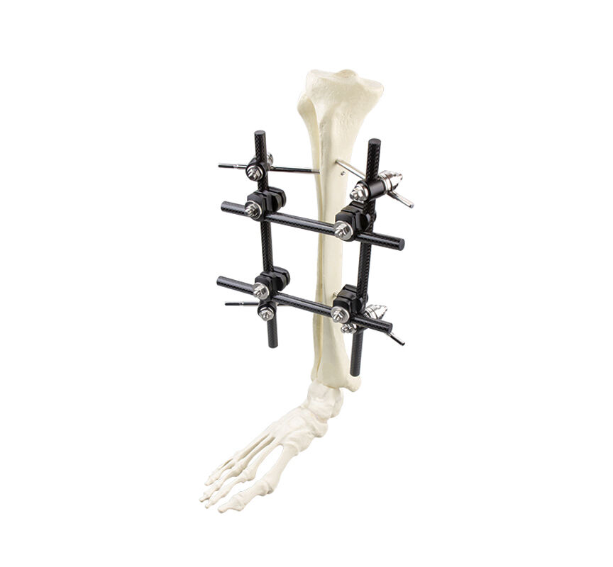 Φ11.0 Series External Fixation Fixator – Tibia Backbone Frame