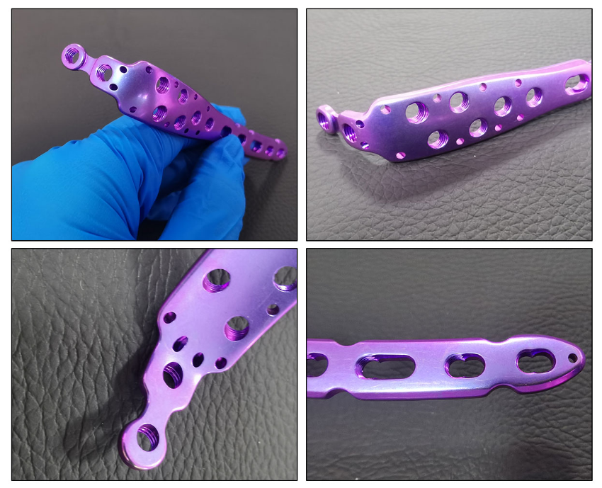 olecranon locking plate907-2