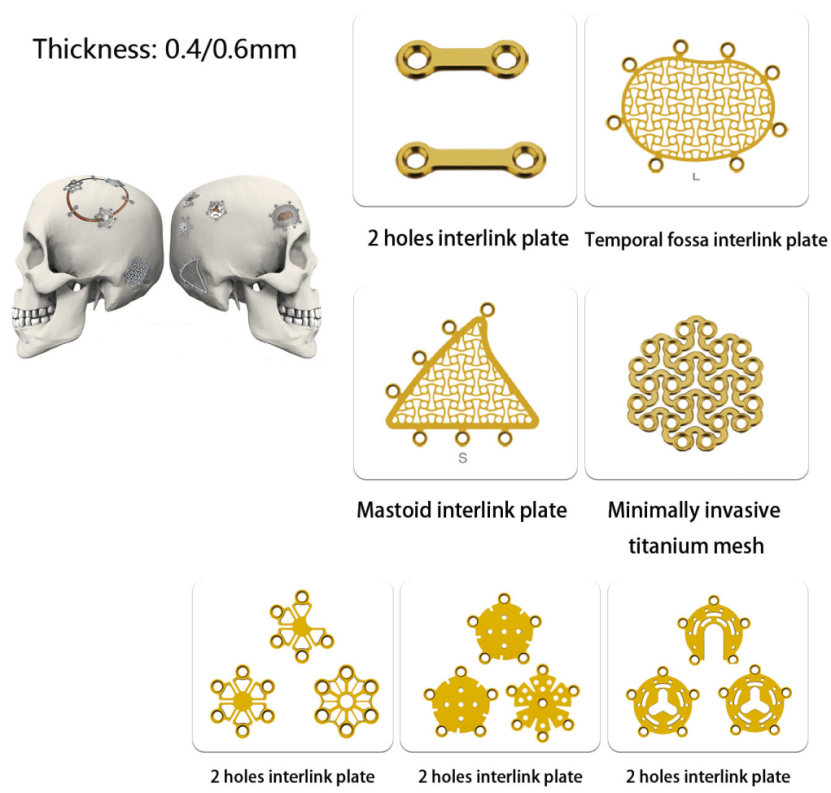 minimally invasive titanium mesh for cranial repair-4