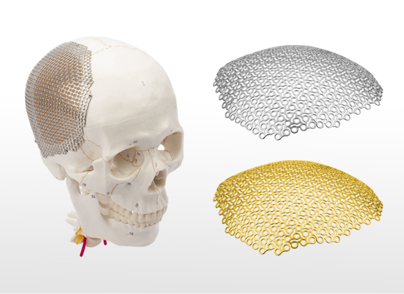 anatomical 3d flower shape titanium mesh used for skull restoration system-1