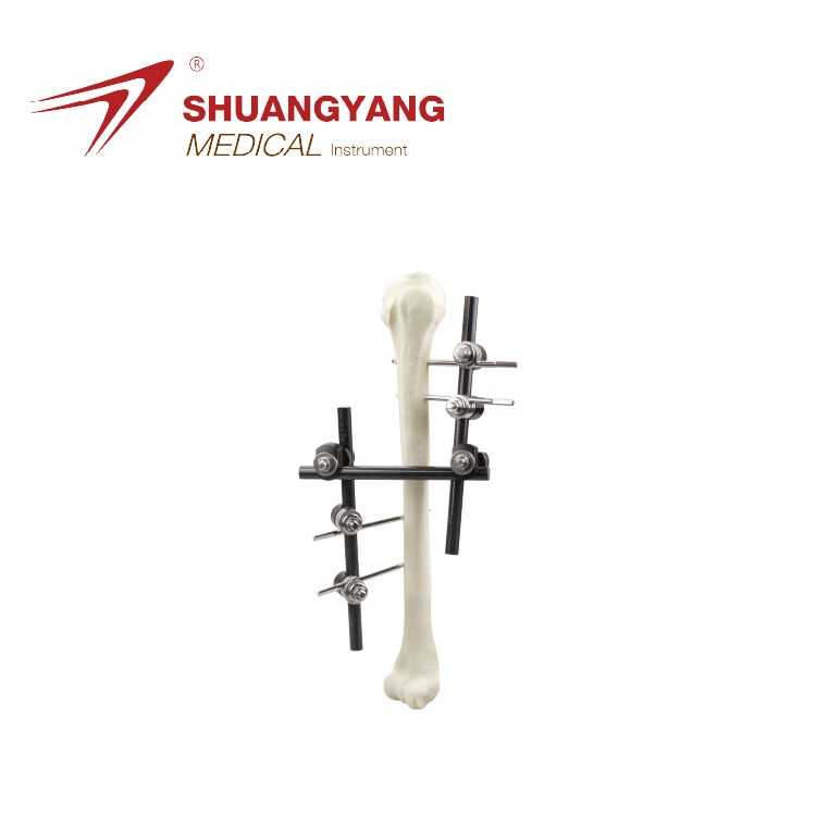 Humerus backbone external fixator