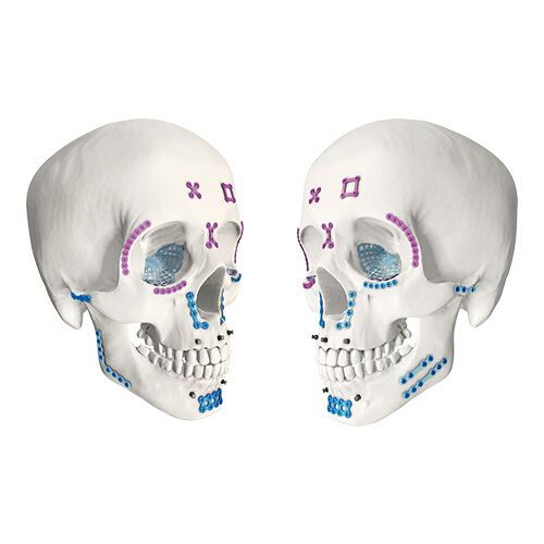 Maxillofacial System