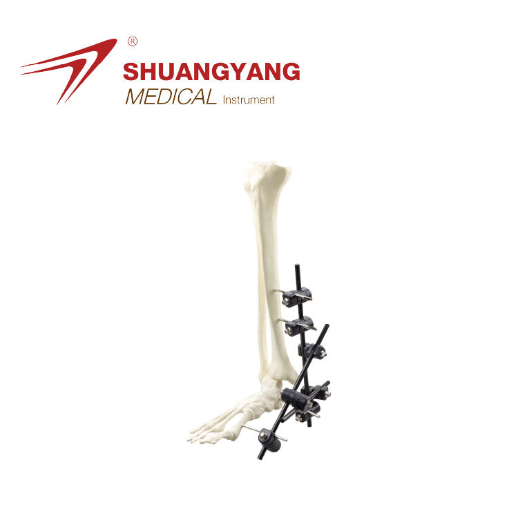 Ankle stabilization external fixator