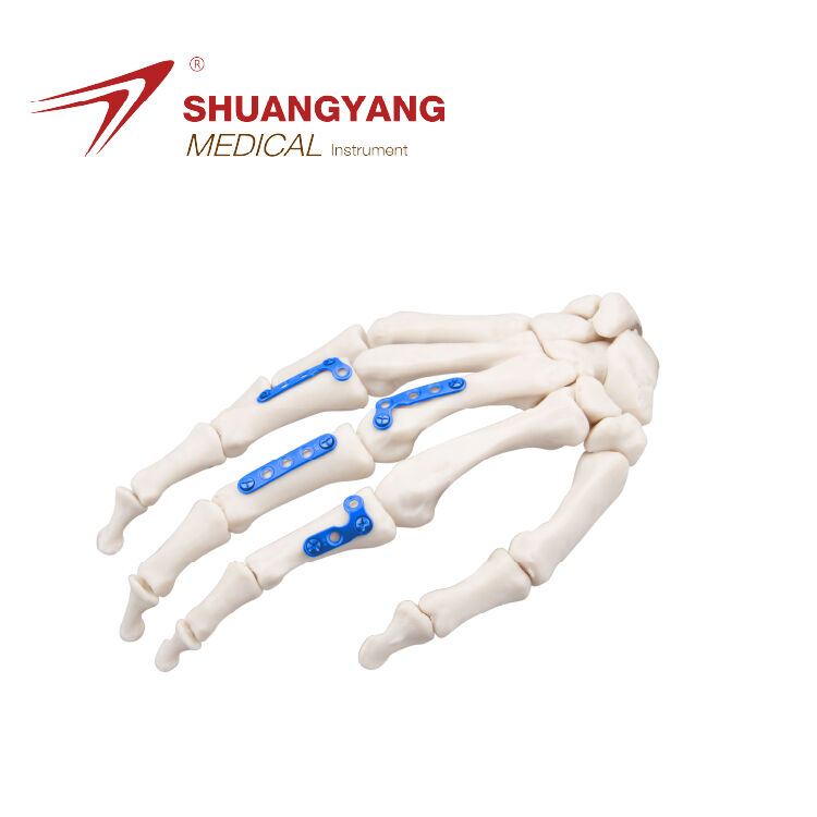 2.0mm Titanium Hand Mini Locking Plate System