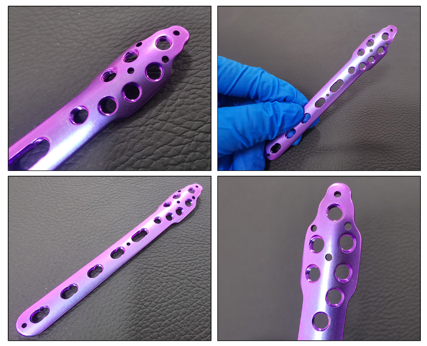 lateral fibular locking plate-3