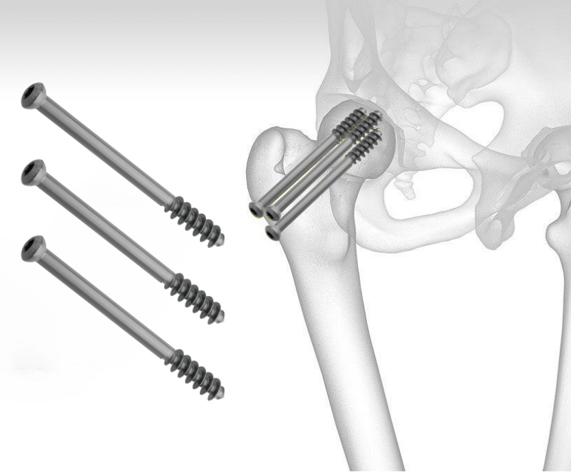 40 cancellous screw-1