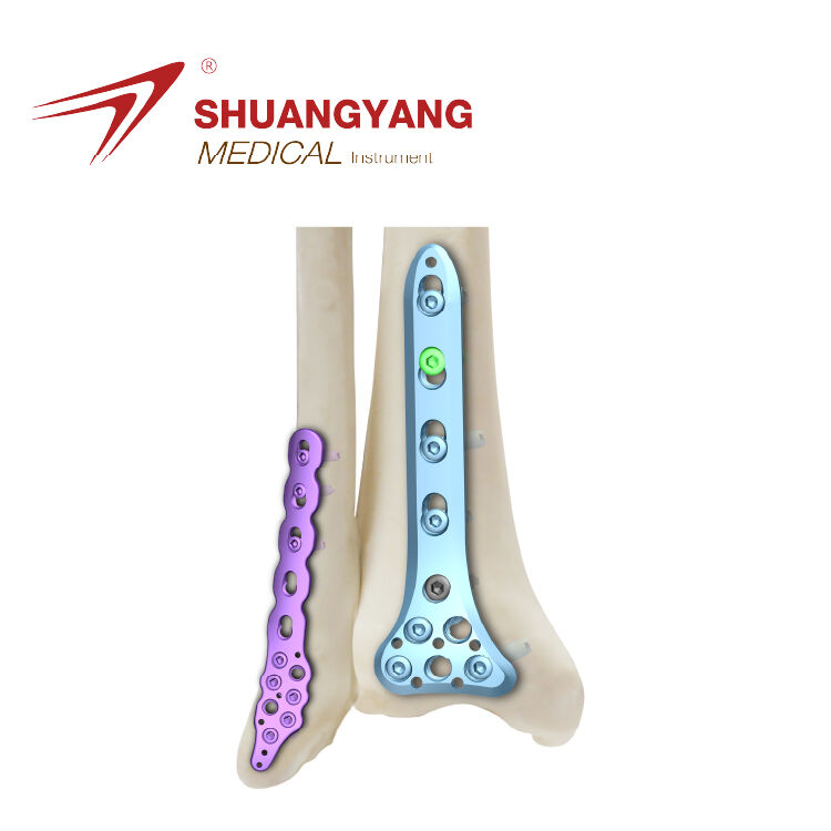 How to benchmark Synthes distal humerus plate against competitors?
