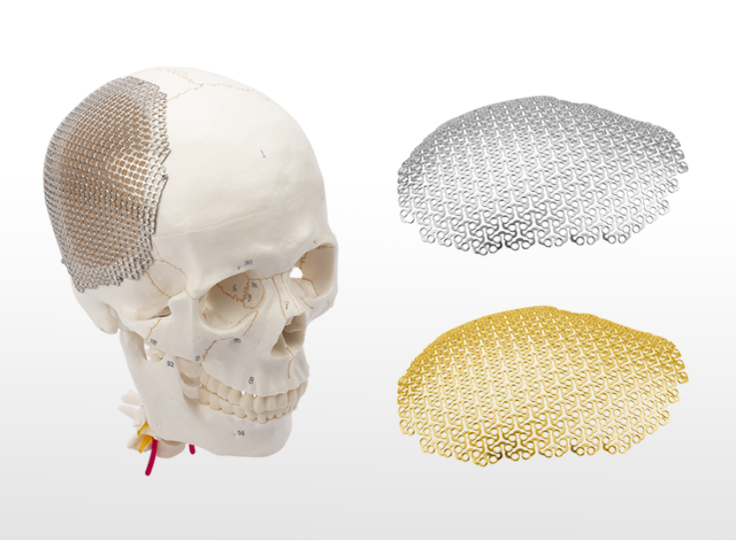 anatomical 3d cloud shape titanium mesh used for skull restoration system-1