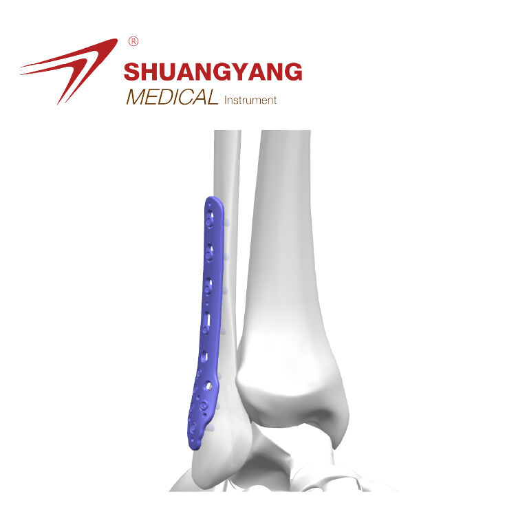 Lateral fibular locking plate