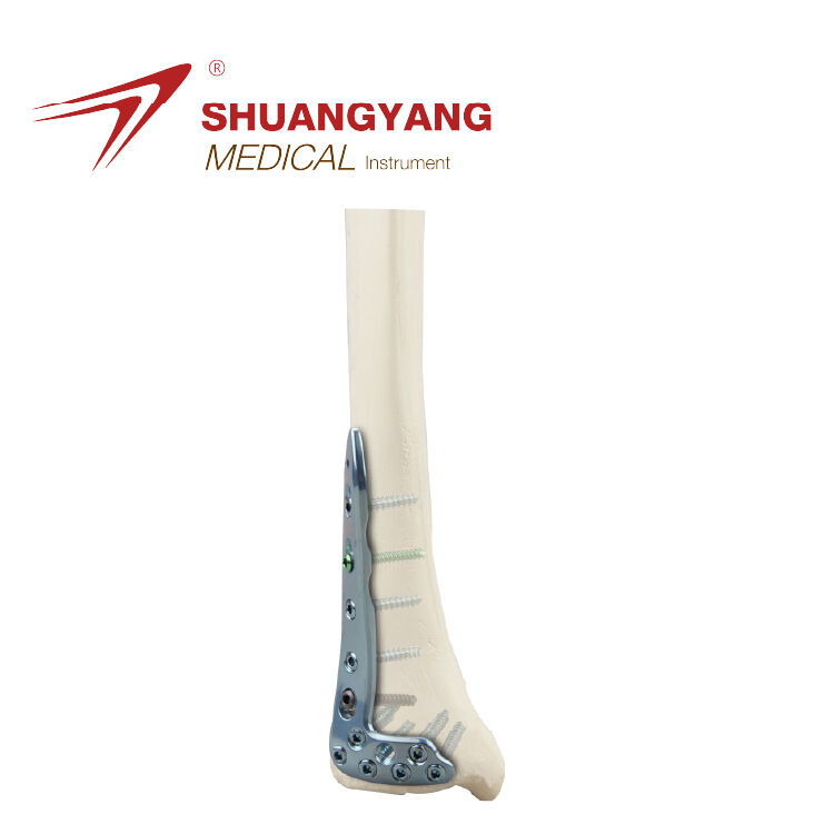 L-shaped Distal lateral tibia locking plate