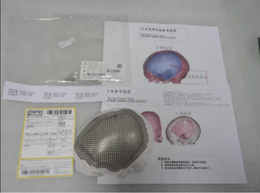 neurosurgery implant 2 holes interlink plate used for skull flap fixation and connection-6