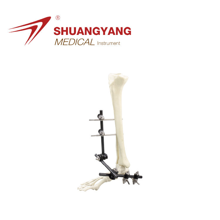 Ankle bridge external fixator 