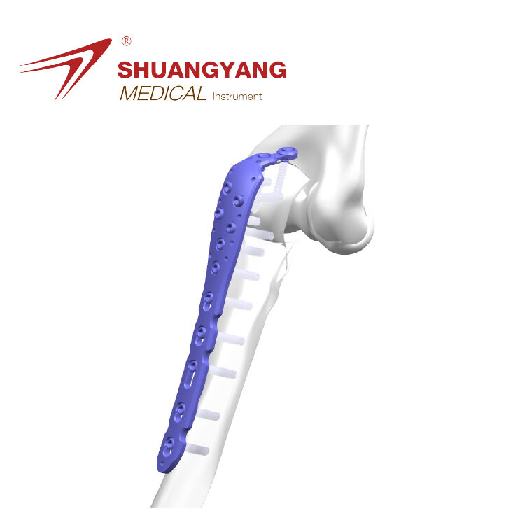 Olecranon locking plate