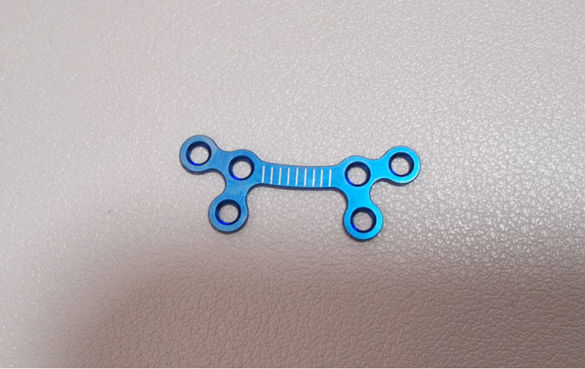 orthognathic series sagittal split fixed plate titanium maxillofacial plate-3