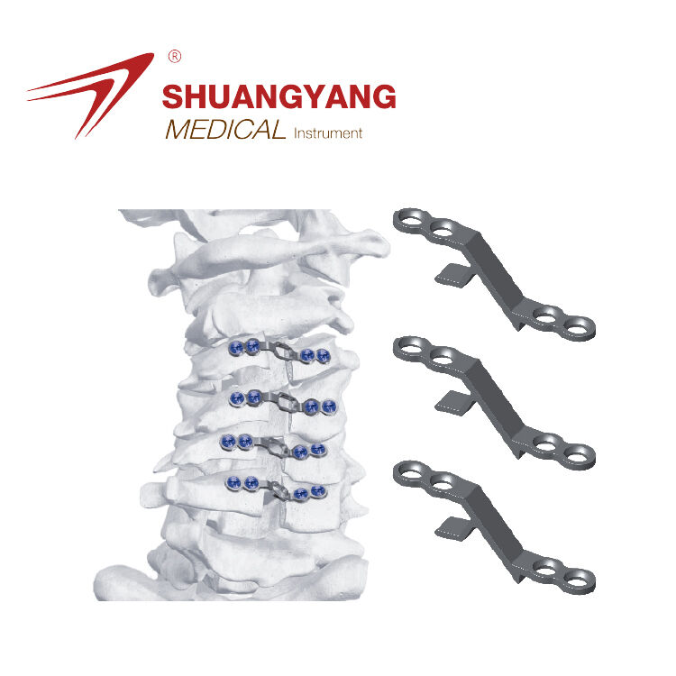 Laminoplasty Fixation System