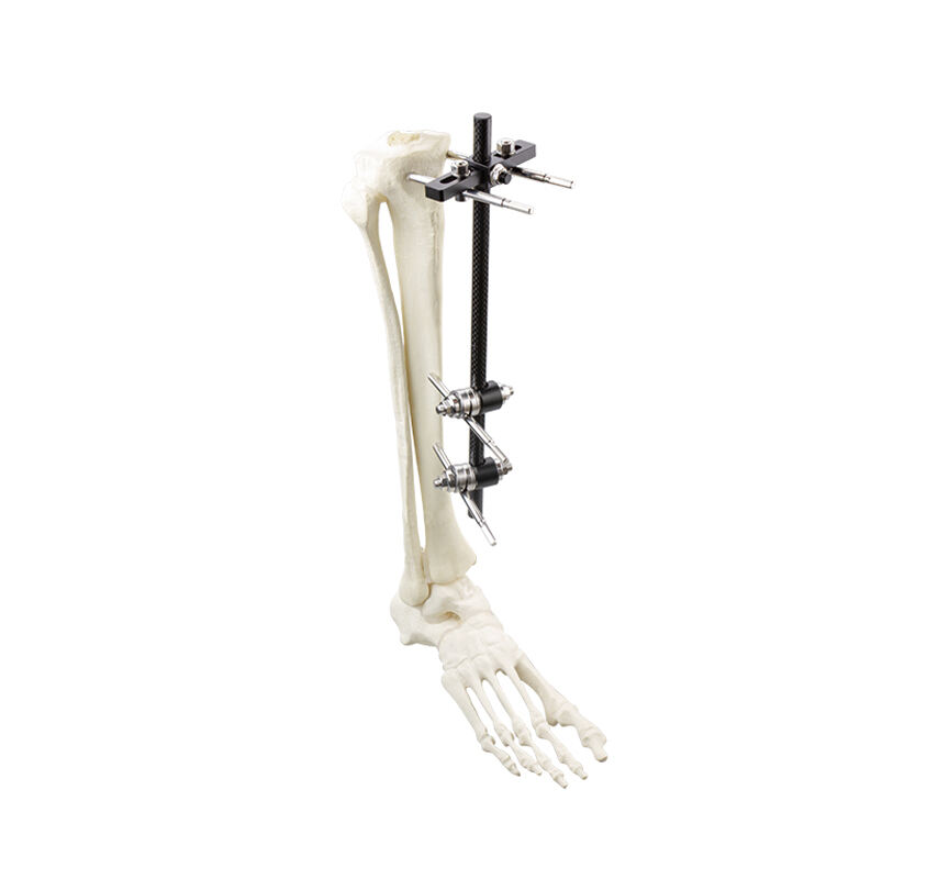 Φ11.0 Series External Fixation Fixator – Tibia Plateau Frame