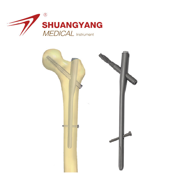 PFNA intramedullary nail