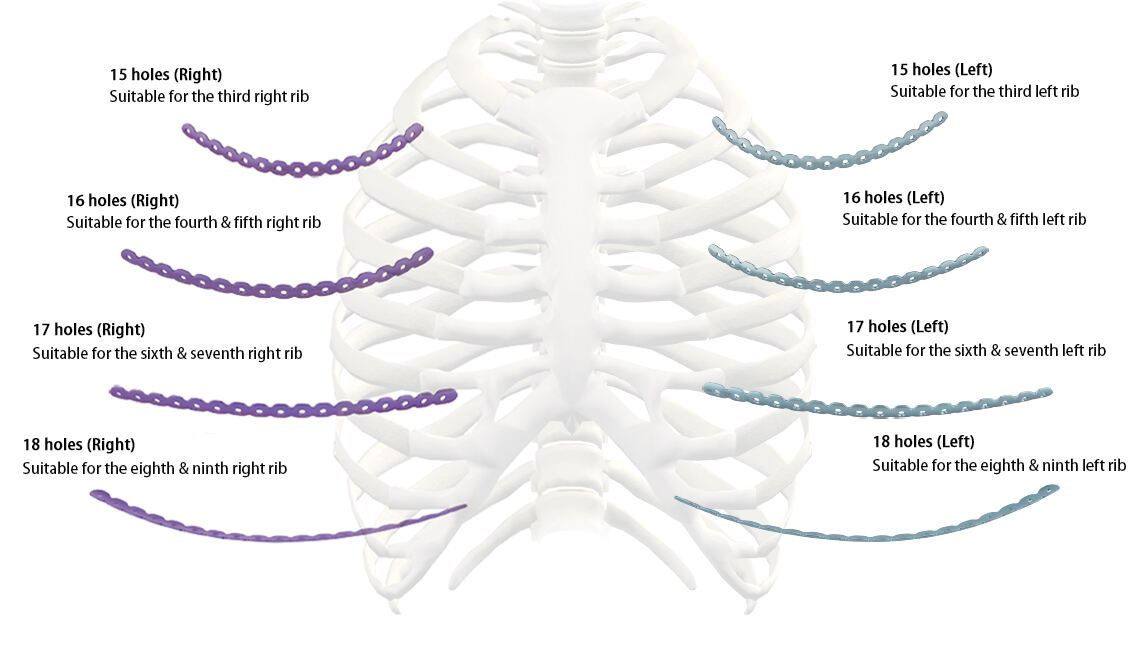肋骨板1.jpg