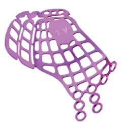 anatomical orbital floor plate-5