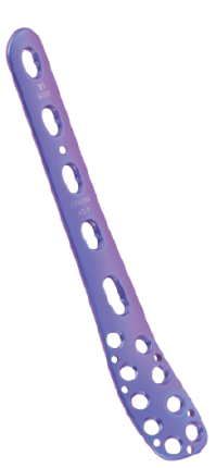 distal fibular locking plate630-4