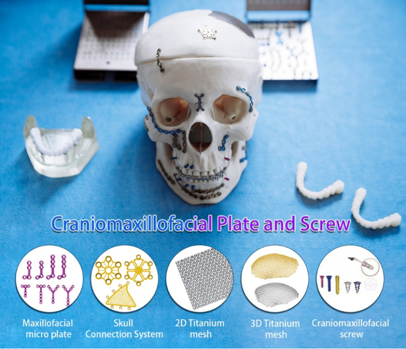 neurosurgery implant mastoid interlink plate-1