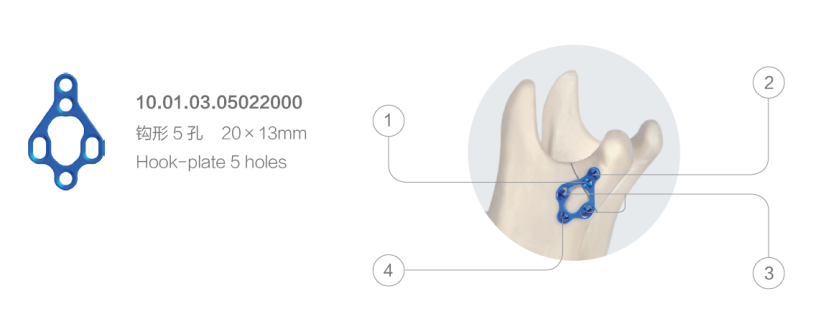 20mm maxillofacial set titanium maxillofacial mini plateanatomical-3