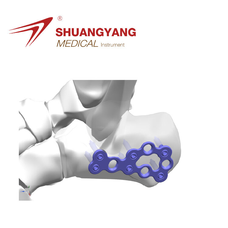 Calcaneal locking plate