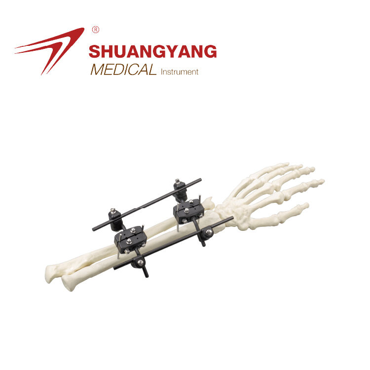 Radius Backbone Modular external fixator