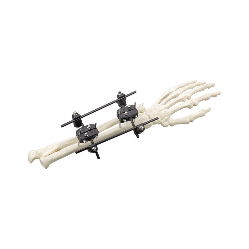 Φ5.0 Series External Fixation Fixator – Distal Radius Frame