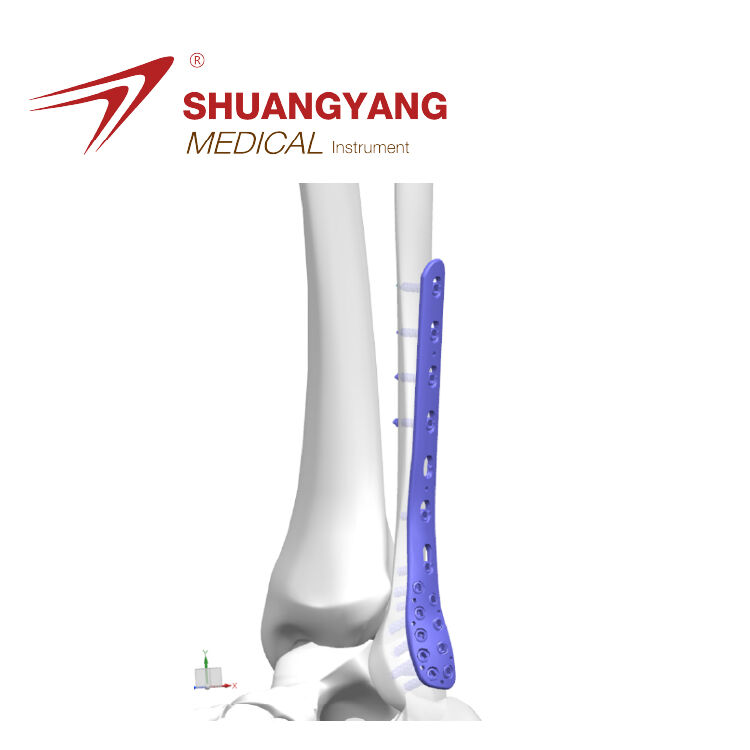 Distal fibular locking plate