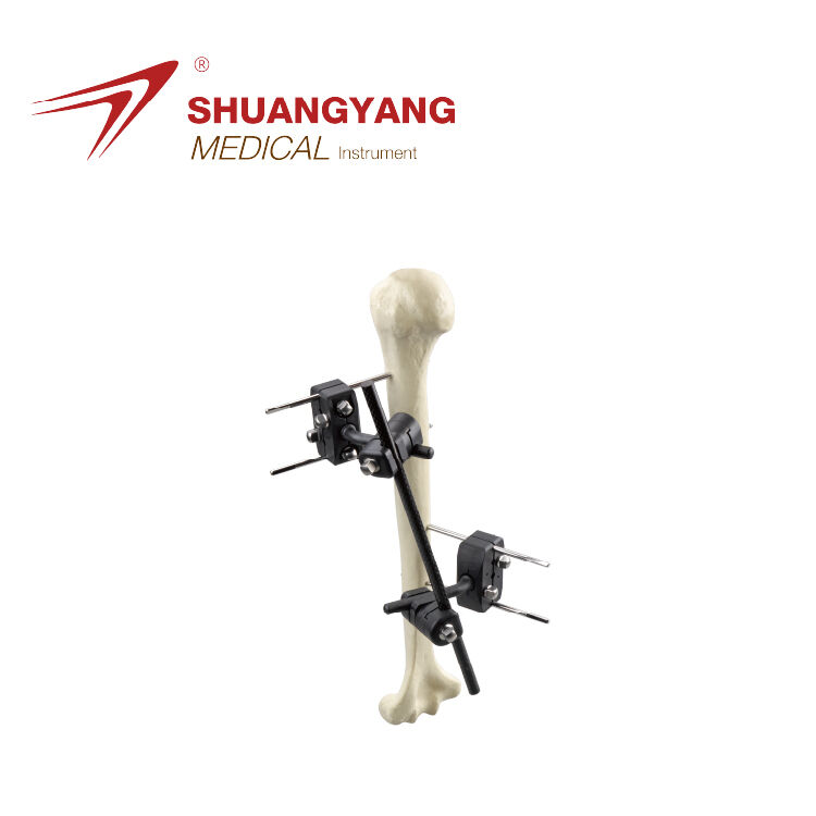 Humerus backbone external fixator