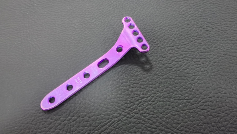 volar locking plate distal type-2