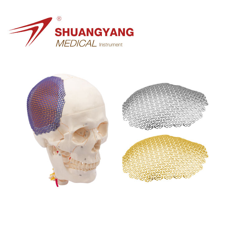 Anatomical 3D cloud shape titanium mesh Used For Skull Restoration System