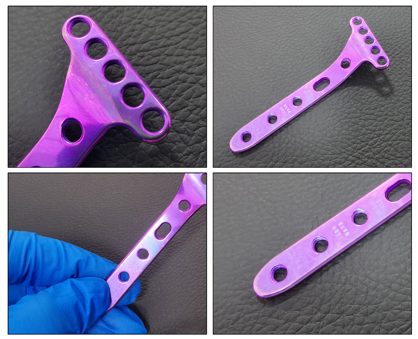 volar locking plate distal type-3